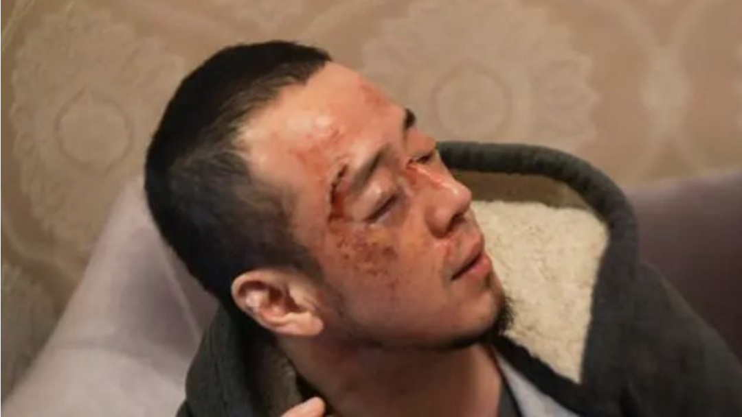 楊坤,回應,本人 楊坤被打？本人回應